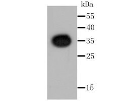 Renilla Luciferase Rabbit anti-Renilla reniformis, Clone: SR07-830, Novus
